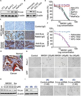 MK591 (Quiflapon), a 5-lipoxygenase inhibitor, kills pancreatic cancer cells via downregulation of protein kinase C-epsilon